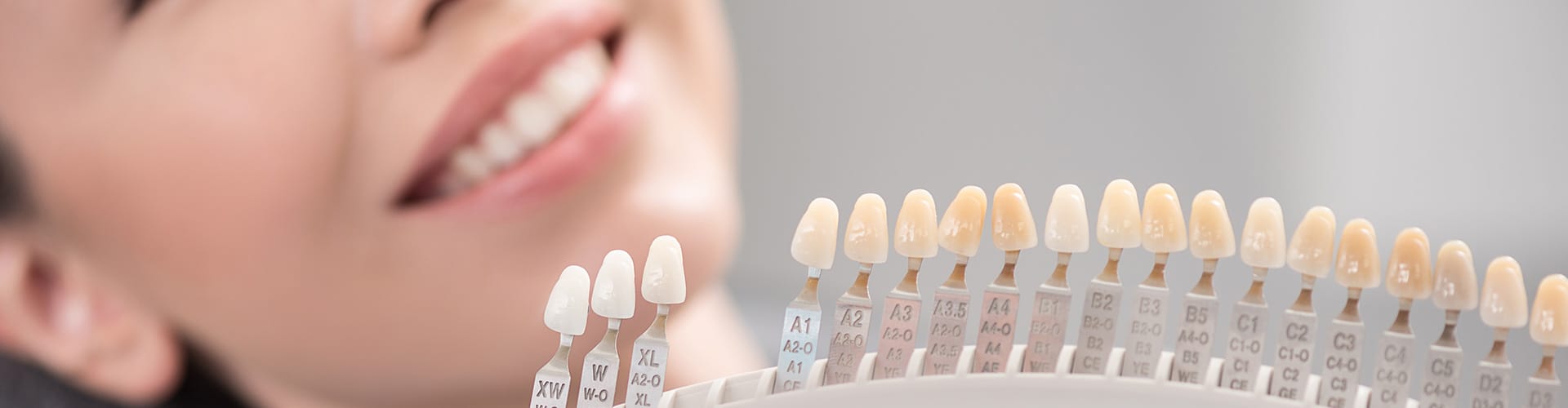 dentalveneers-hero