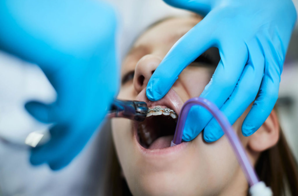 a young girl has her teeth cleaned while wearing braces