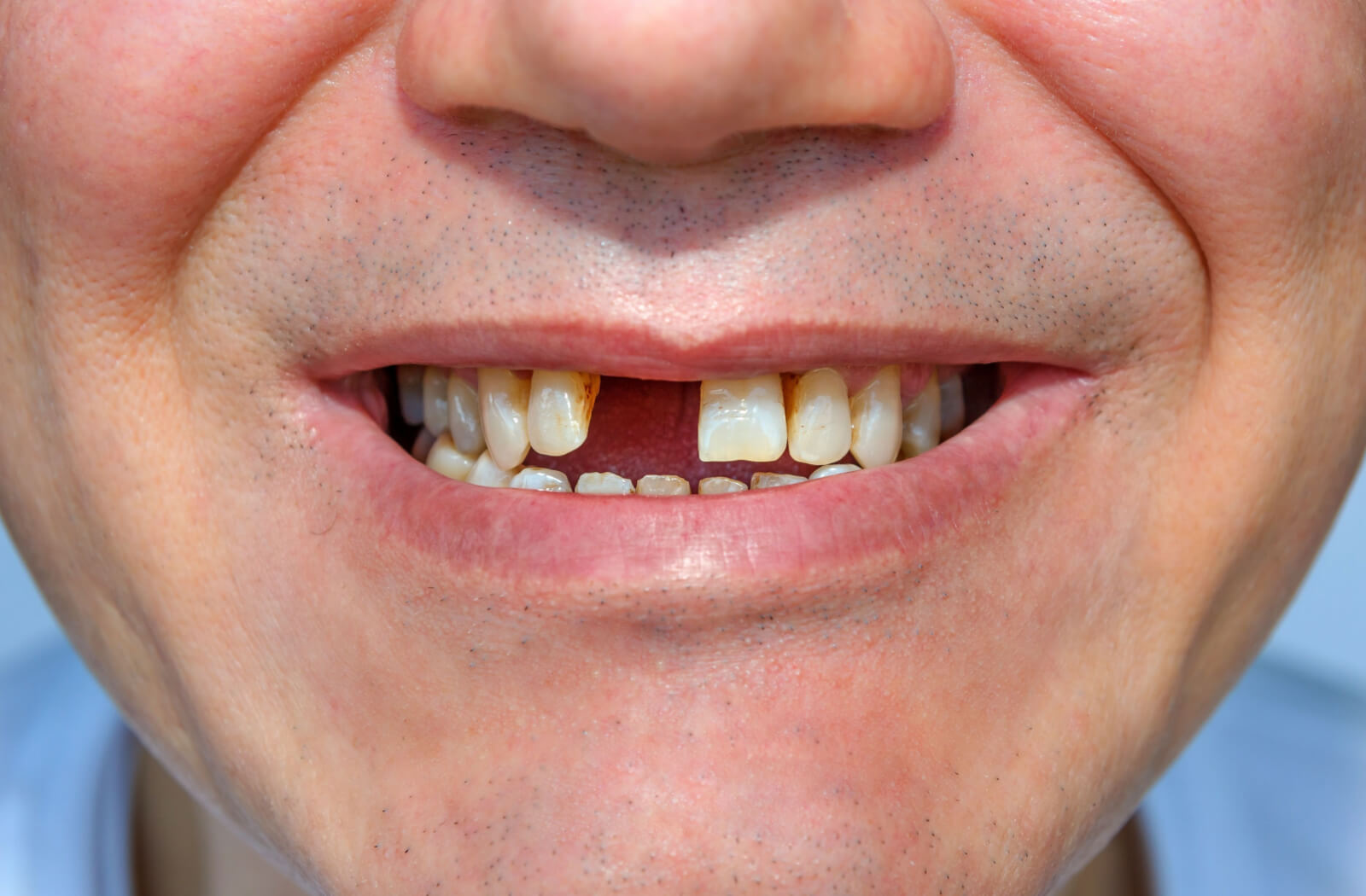 Blog Hero